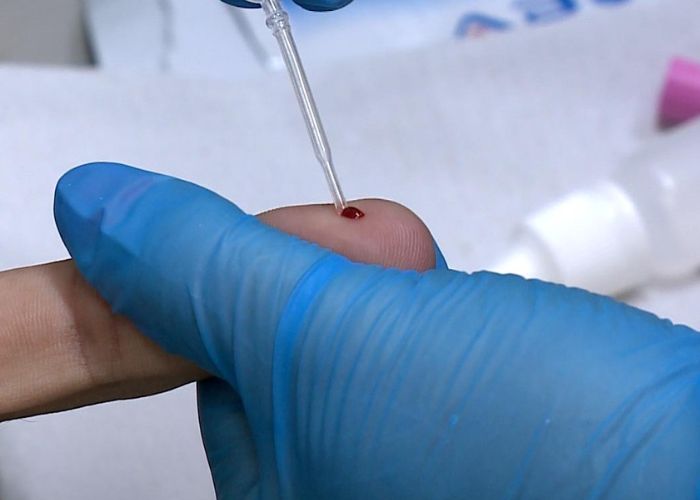 Viva com Saúde: prevenção e diagnóstico precoce das hepatites