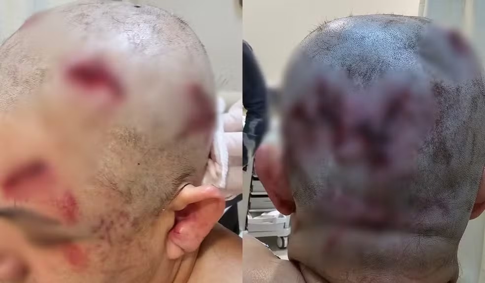 mulher Marretadas cabe&ccedil;a