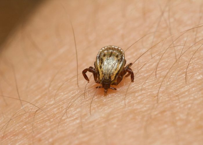 Morte por febre maculosa é confirmada em Várzea Paulista