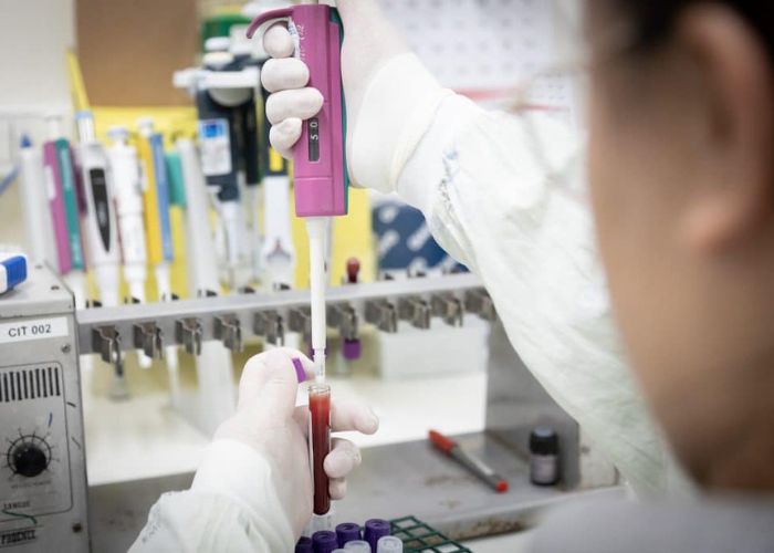 S&atilde;o Paulo descarta segundo caso suspeito de Ebola em 2026