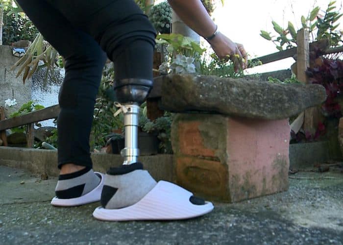 Professora de São Roque transforma dor em superação e busca nova prótese para ajudar na mobilidade