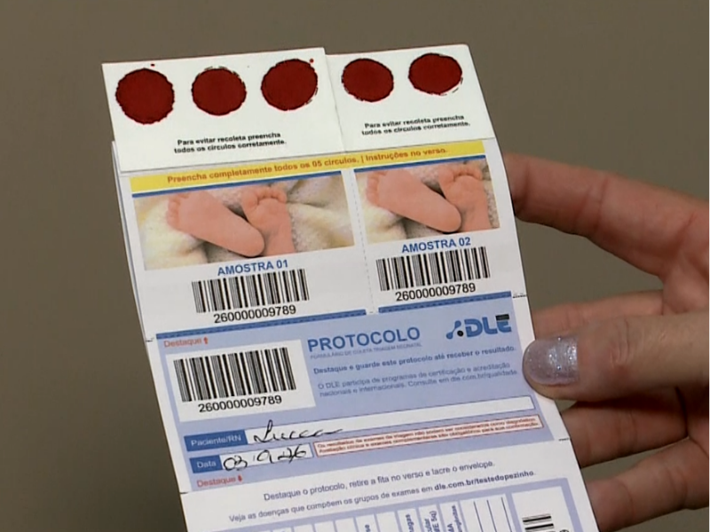 Viva com saúde: diagnóstico precoce pode melhorar perspectivas dos pacientes com fibrose cística